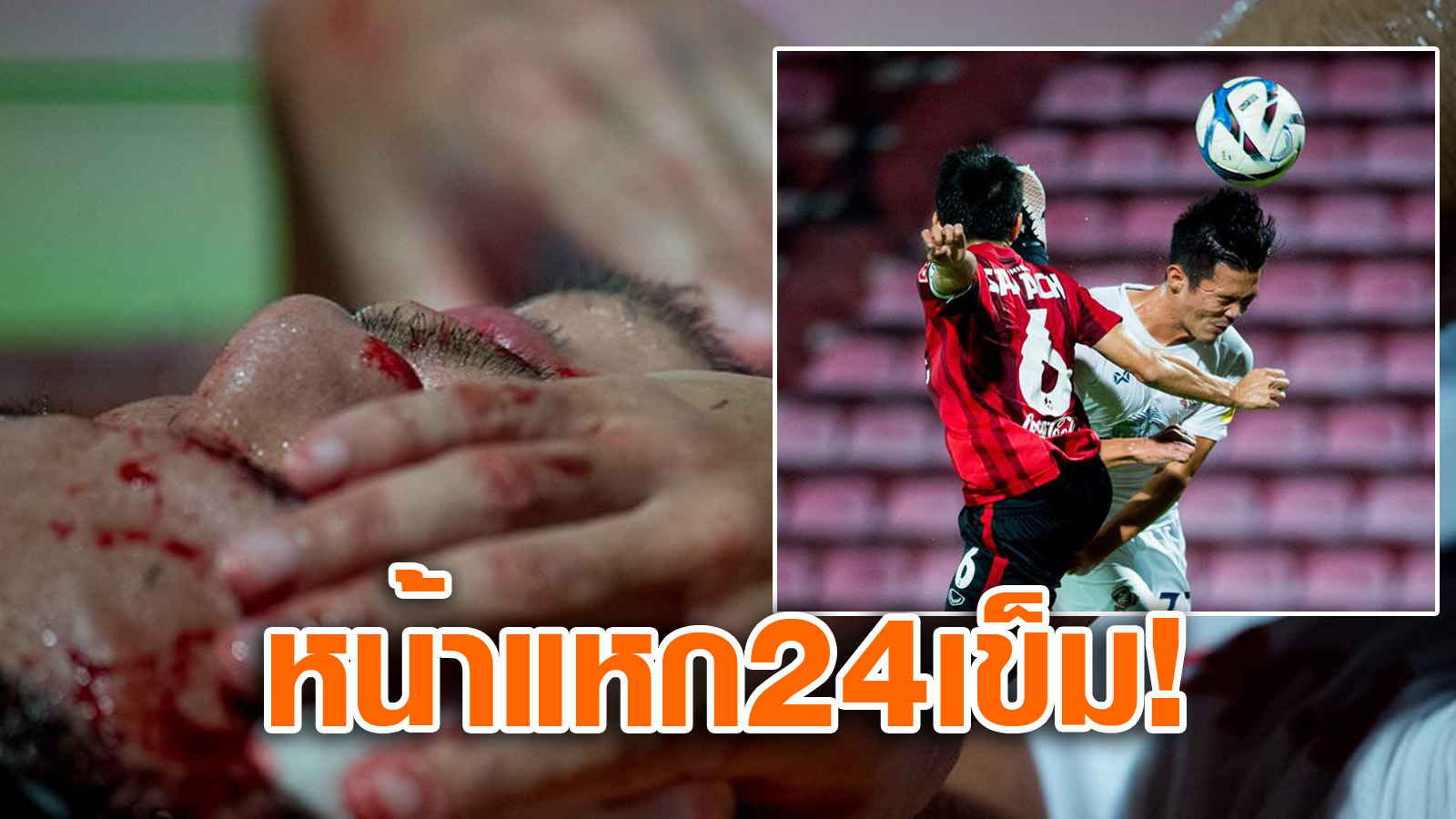 วิเคราะห์บอล ทีเด็ดบอล - หน้าแหก!-สารัชกระโดดยัน-“อากาโฮชิ”-เย็บใบหน้า-24-เข็ม